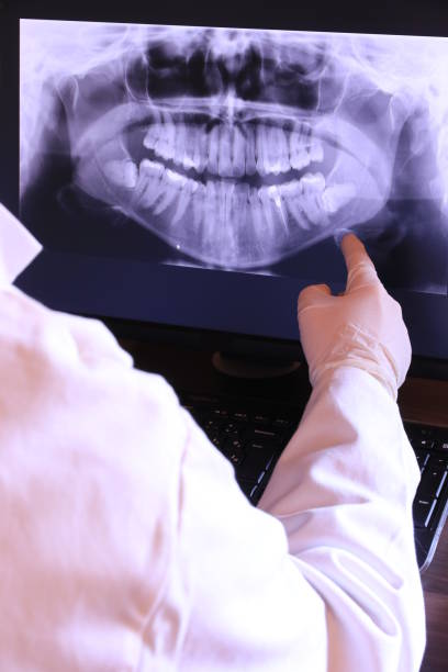 Best Emergency Dentist for Lost Fillings or Crowns in Elmont, NY